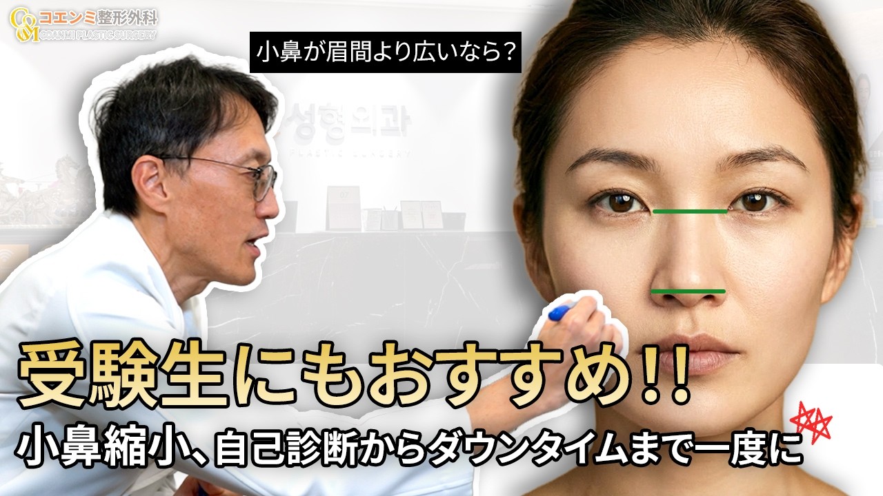 [学生にもおすすめ]　小鼻縮小 自己診断してみよう