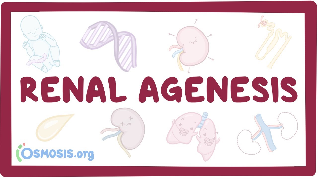 Renal agenesis (unilateral, bilateral, oligohydramnios) - causes, symptoms & pathology