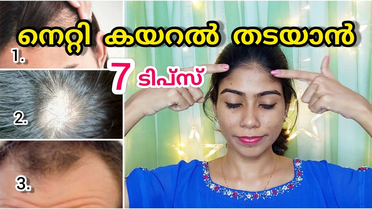 🌸😯നിങ്ങളുടെ മുടി കൊഴിയുന്നത് ഇങ്ങനെ ആണോ??How to get rid of forehead hairfall at home?Malayalam|Nerin