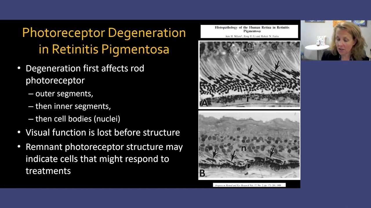 RPB Lunch & Learn: Eye on Retinitis Pigmentosa
