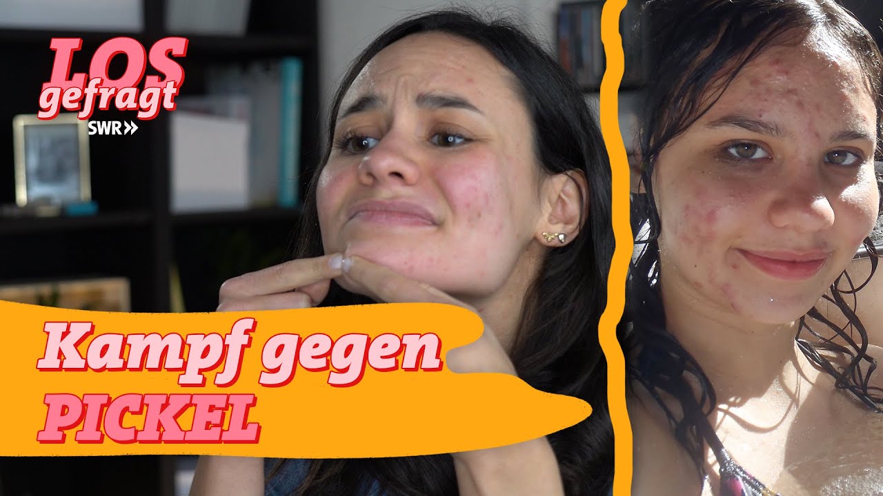 Was tun gegen Pickel?! | Losgefragt
