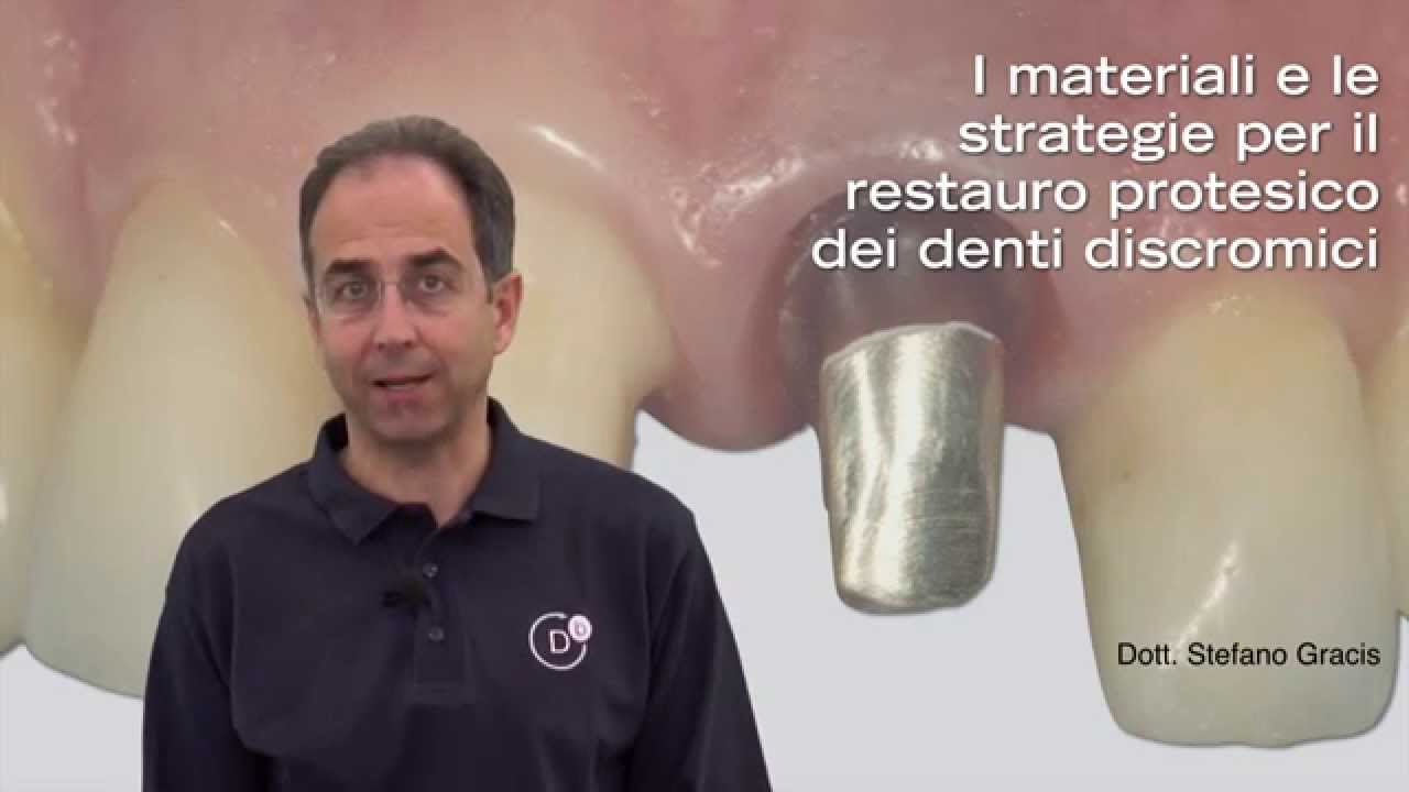 MATERIALI E STRATEGIE PER IL RESTAURO PROTESICO DEI DENTI DISCROMICI