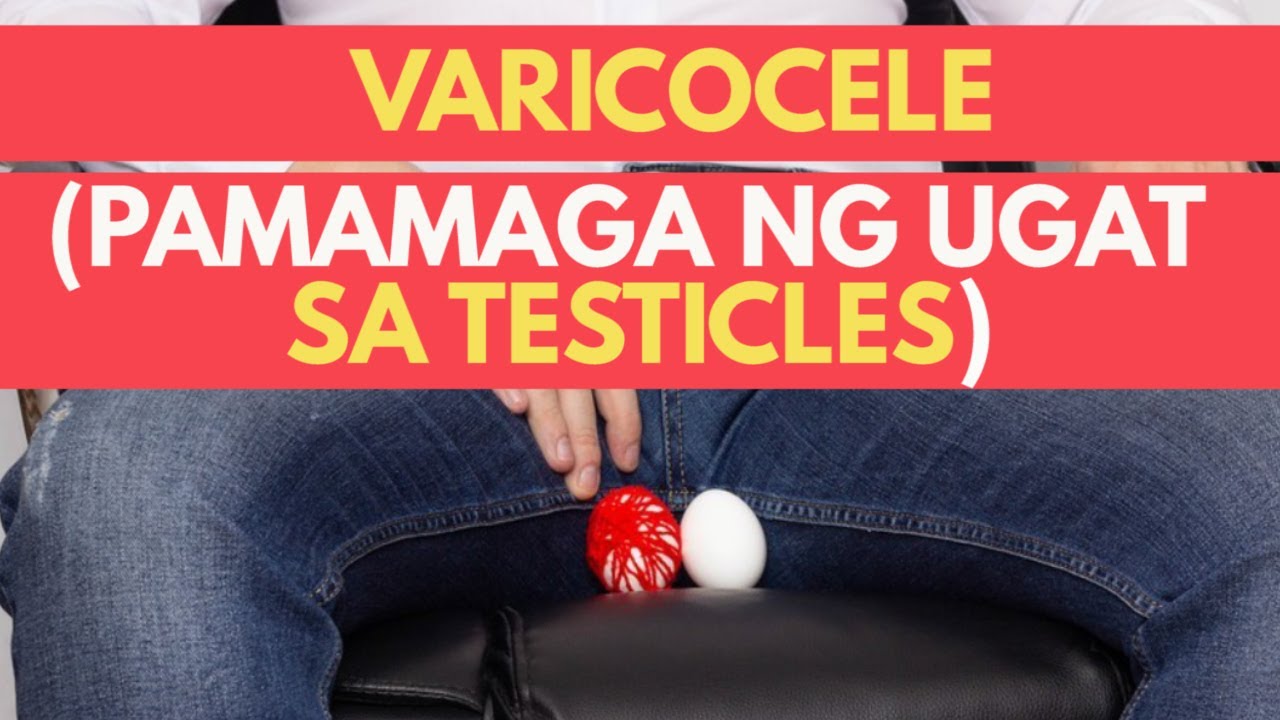 VARICOCELE [PAMAMAGA NG UGAT SA BAYAG] EXPLAINED BY UROLOGIST DR. JOSEPH LEE
