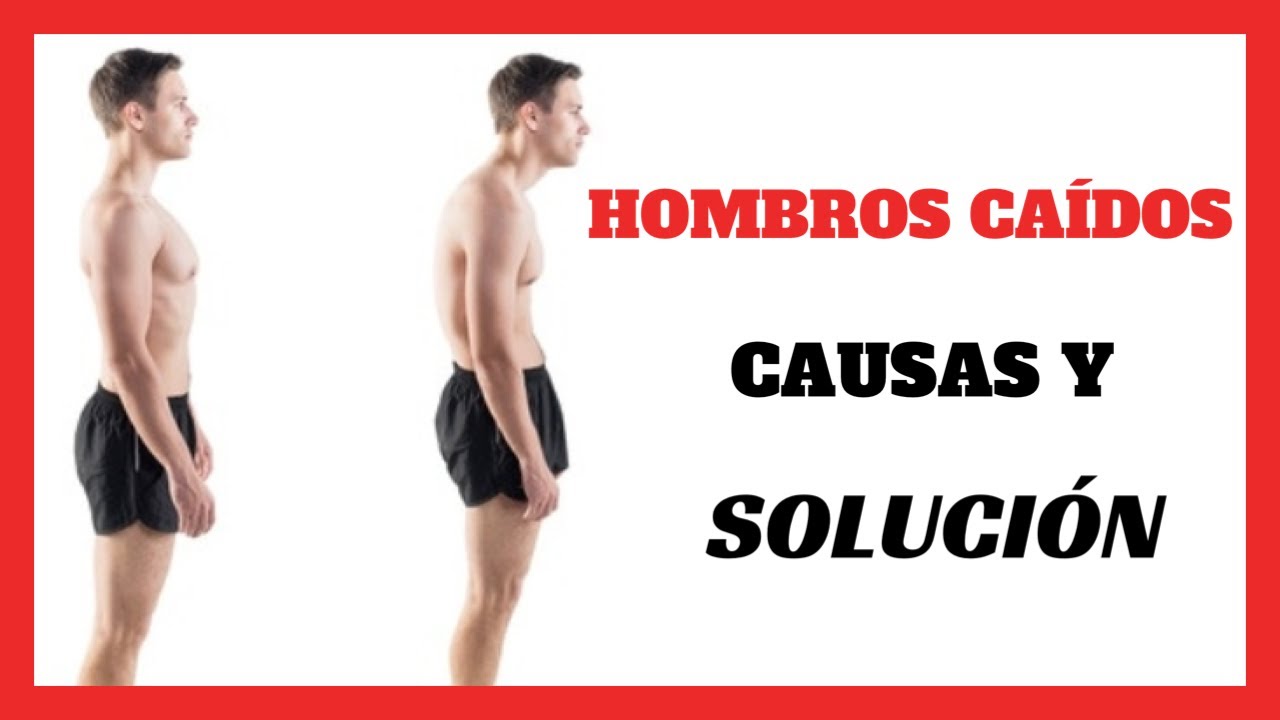 HOMBROS CAIDOS causas y SOLUCION ✅▶ Corrige tu Postura con este Ejercicio [FUNCIONA!]