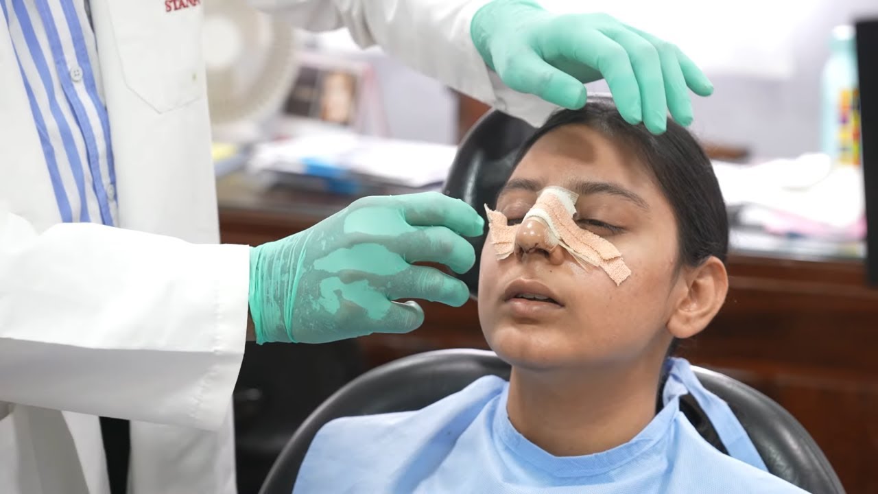 Removing a Nasal Splint on the 7th Day After Rhinoplasty