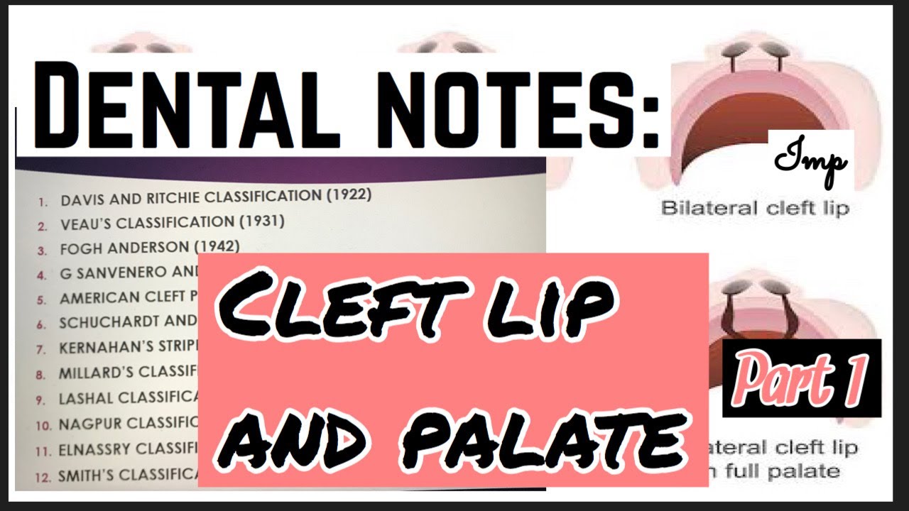 CLEFT LIP AND PALATE II PART 1