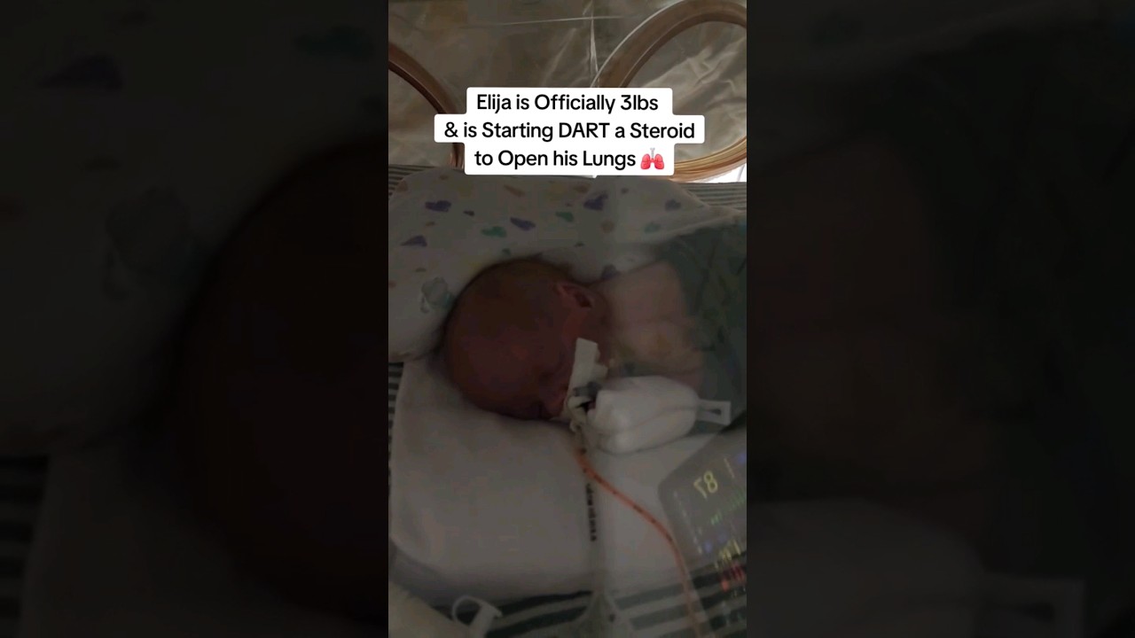 Micro Preemie Baby Journey 