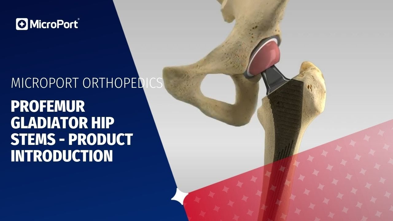 Profemur Gladiator Hip Stems - Product Introduction