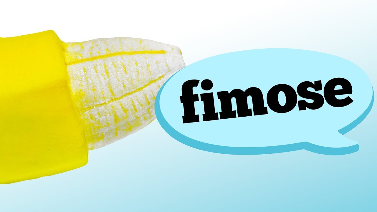TIPOS DE FIMOSE E SEUS SINTOMAS