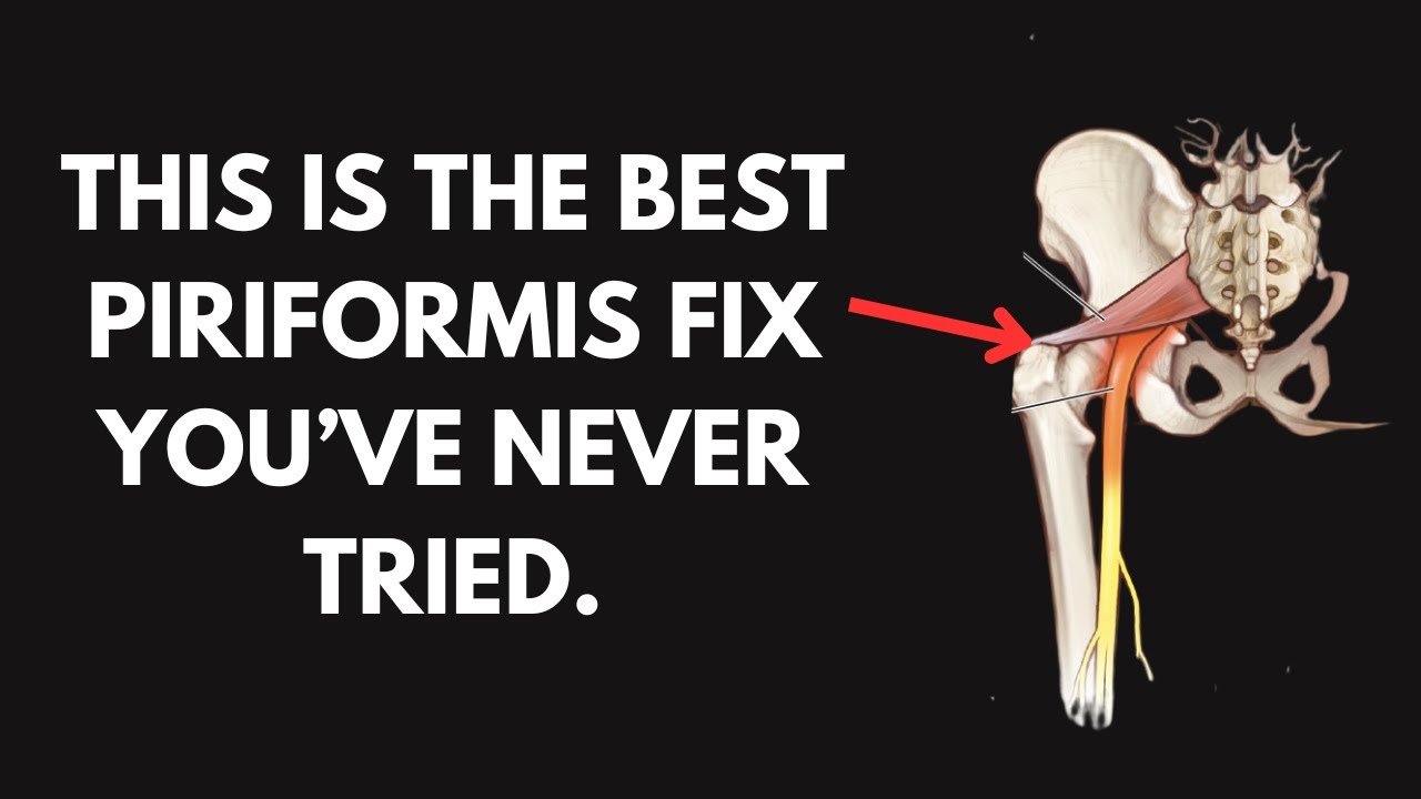 How To (actually) Fix A Tight Piriformis