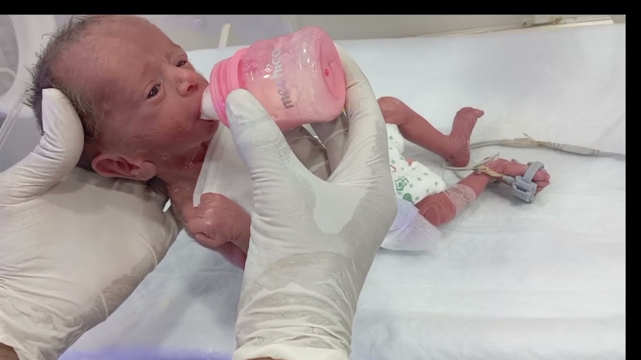 Preterm & Premature Baby in NICU | First Feeding After Long Treatment #viralvideo #nicucare #newborn