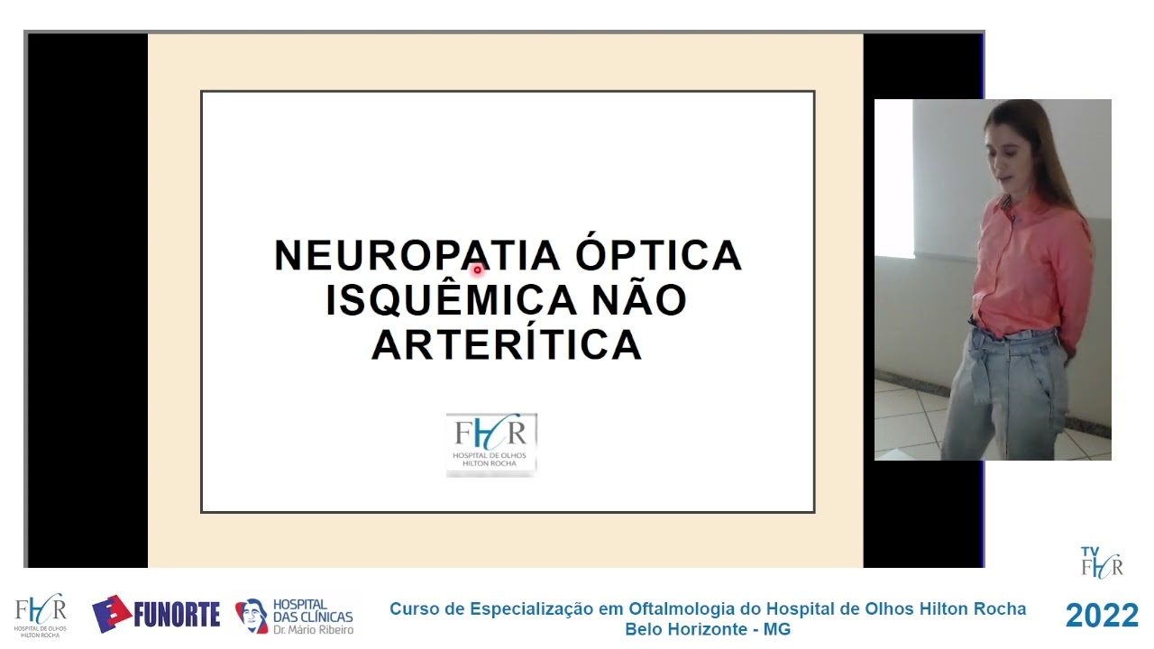 Neuropatia Óptica Isquêmica   Arterítica e Não Arterítica Dra Patrícia Dra Naiara 02 05 22