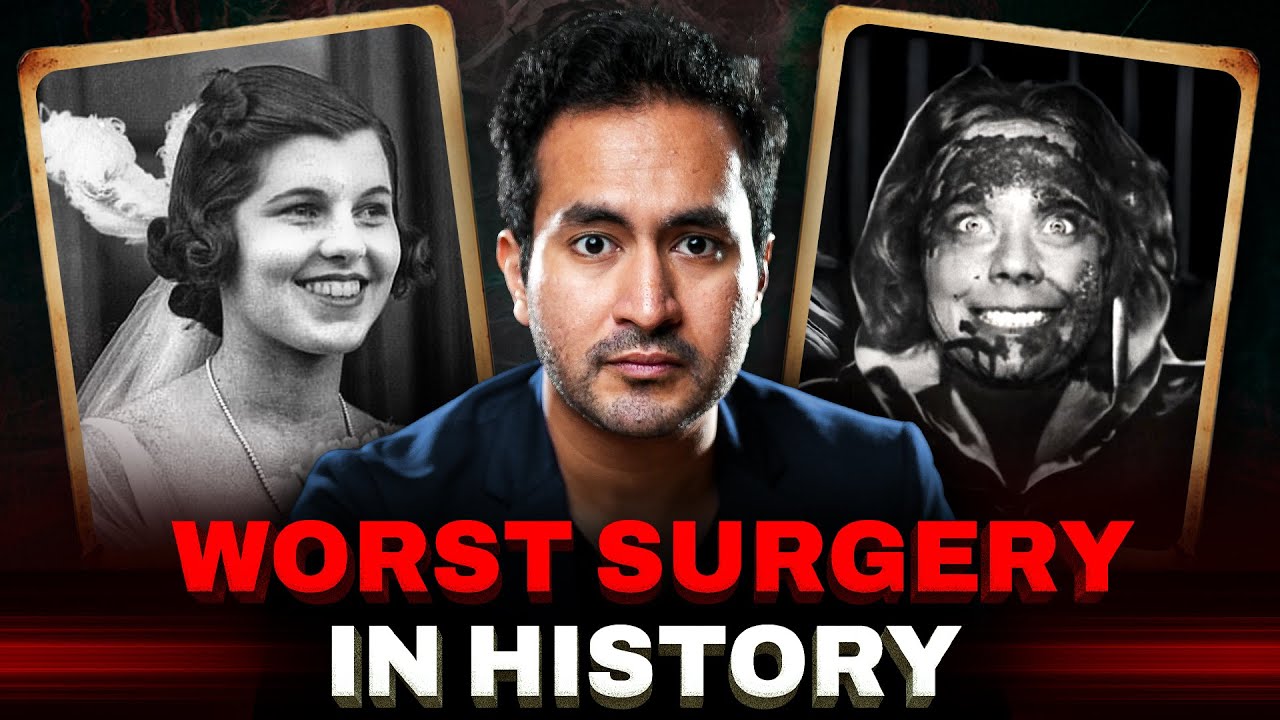 Lobotomy – The Most Horrifying Surgery in History