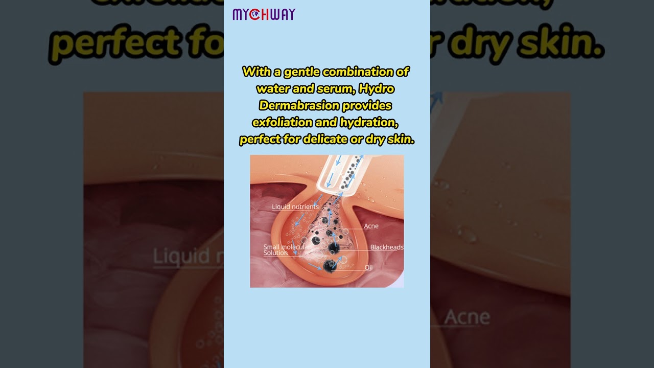 Which is Superior: Hydro Dermabrasion or Microdermabrasion? #mychway #hydrationboost