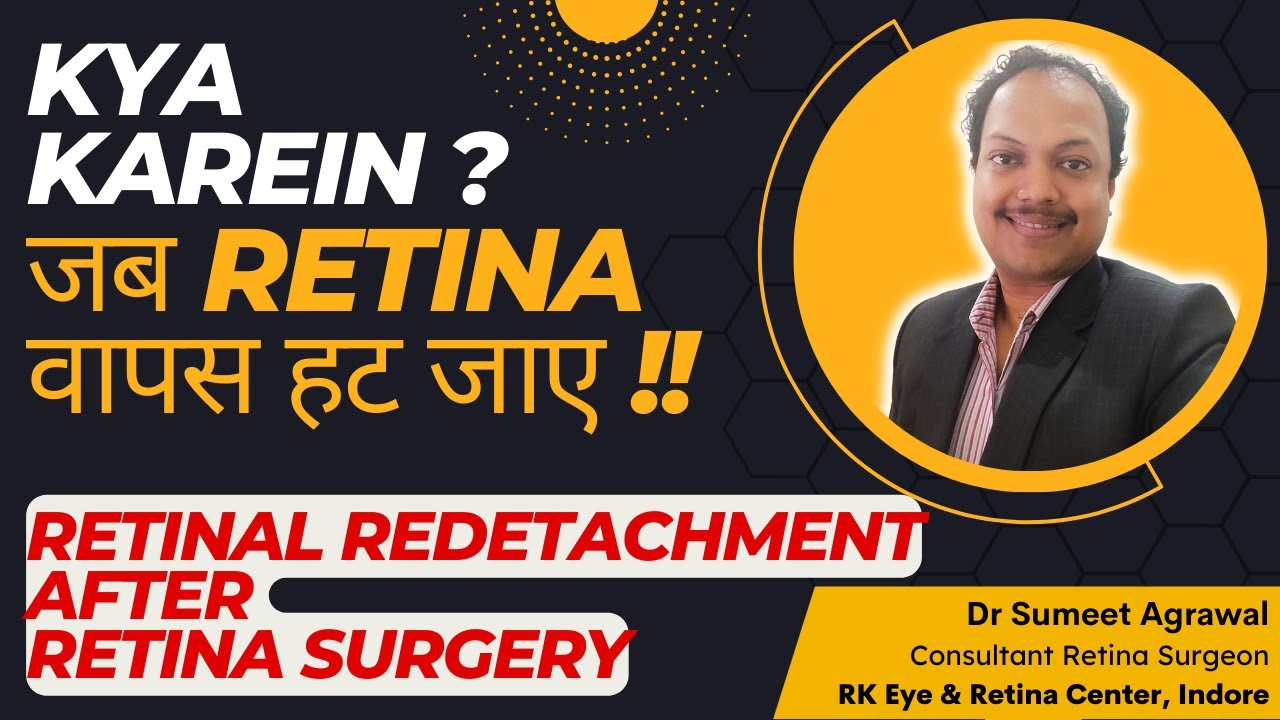 What to do when the retina retracts after surgery? Retinal Redetachment: Why does it happen? What...