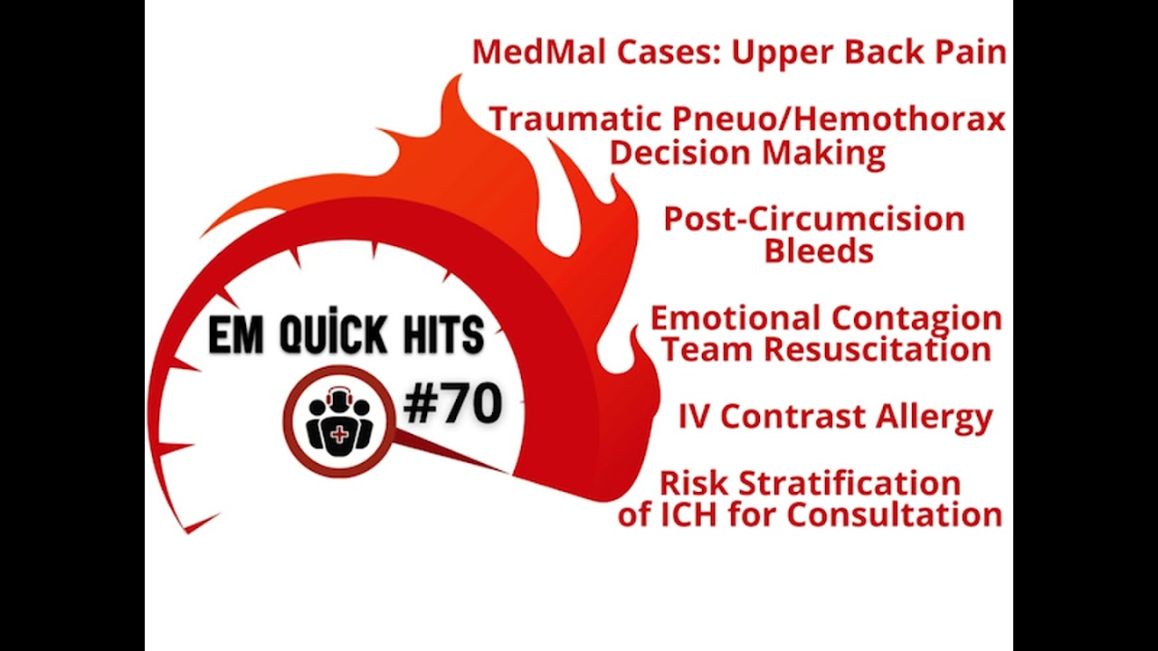 EM Quick Hits 70 MedMal Cases Upper Back Pain, Traumatic Pneumothorax/Hemothorax Decision Making,...
