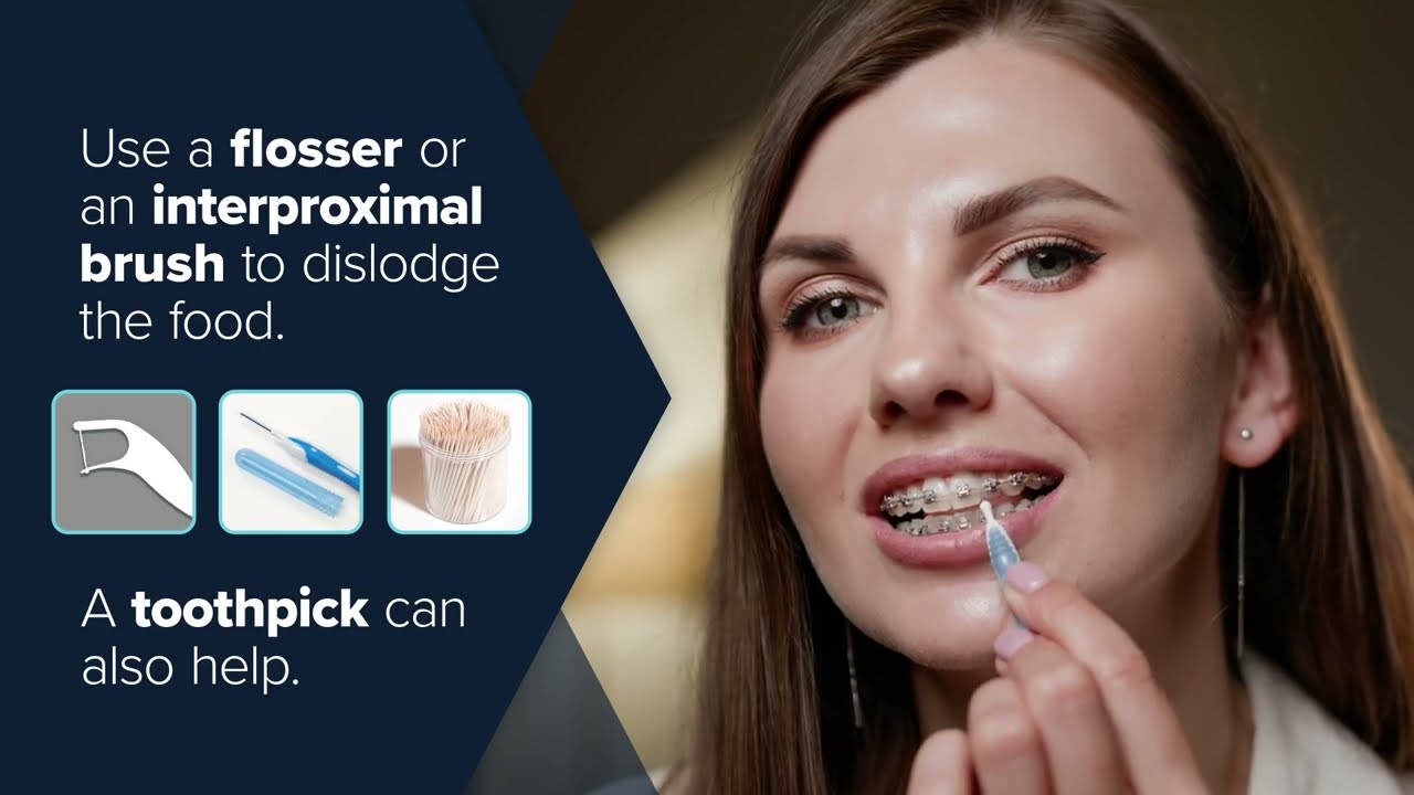 Orthodontic Associates | Emergencies and Soreness