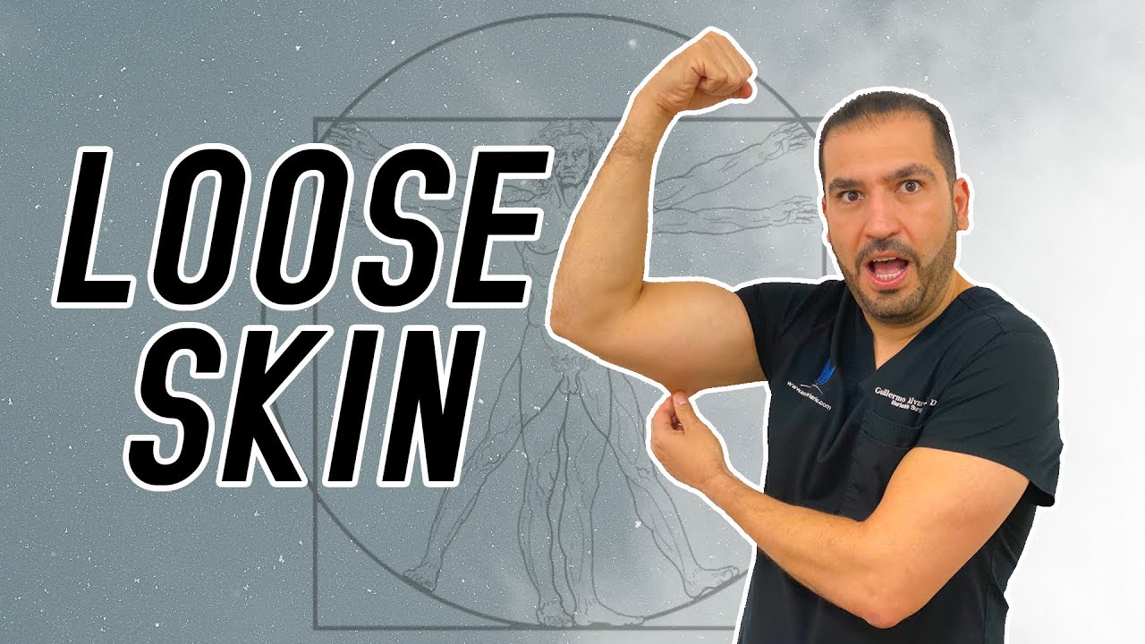 Loose Skin | Gastric Sleeve Surgery | Questions and Answers