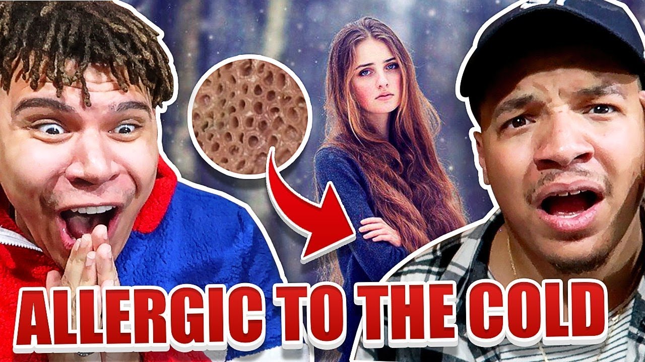 Reacting To The WORLDS STRANGEST ALLERGIES!! (She's Allergic To Water) FT. WOLFIE