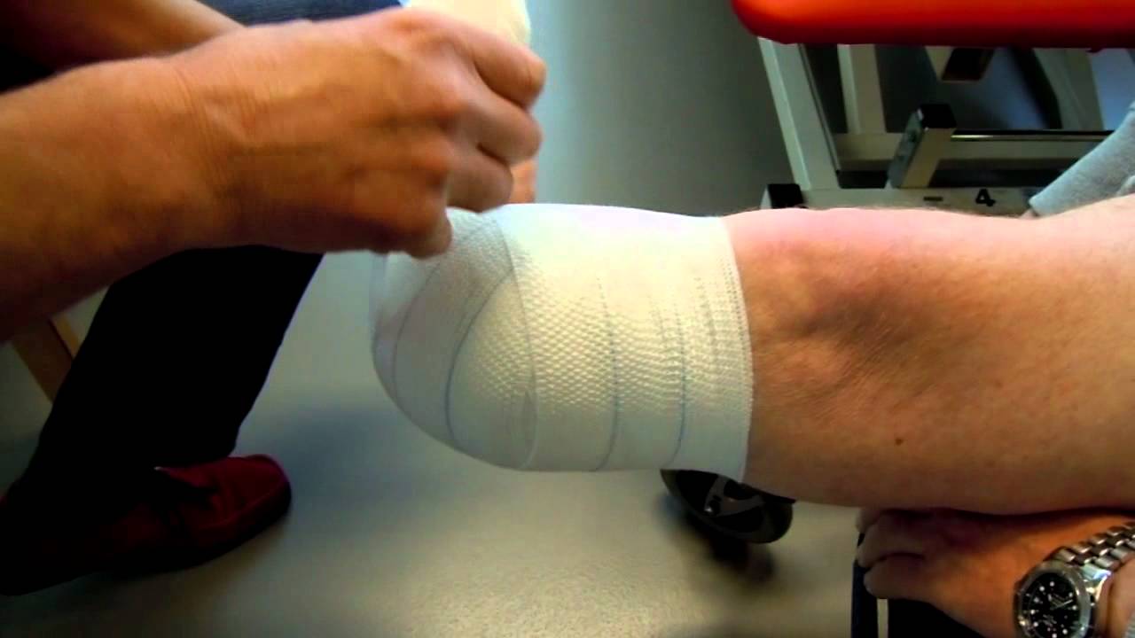 Zwachtelen van stomp bij amputatie been onder de knie