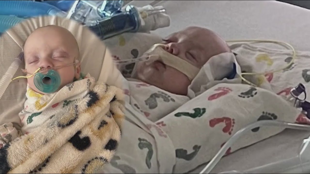 &lsquo;Definitely the scariest&rsquo;: RSV puts babies in ICU