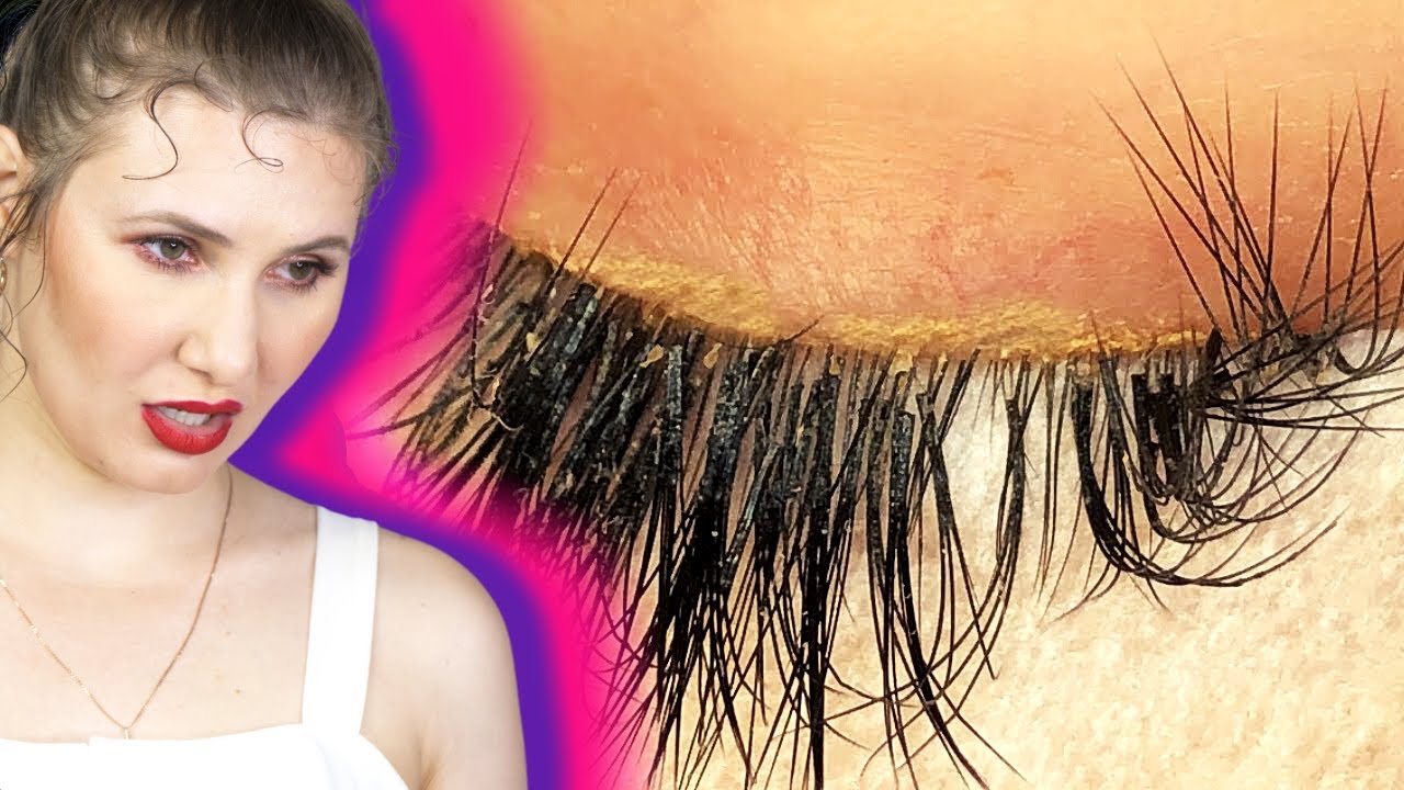 DEEP CLEANSING ON A GUEST WITH MAKEUP BUILD UP AND DEAD SKIN PARTICLES