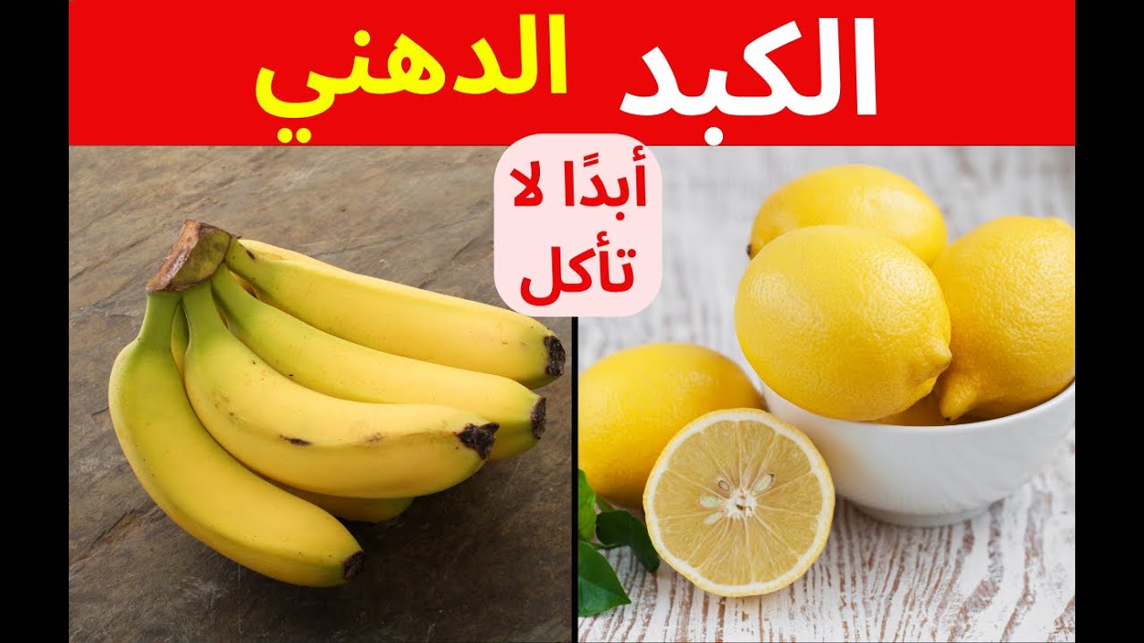 5 أطعمة ممنوعة لمرض الكبد الدهني و10 فواكه مفيدة للتخلّص من دهون الكبد (التنكس الدهني الكبدي)
