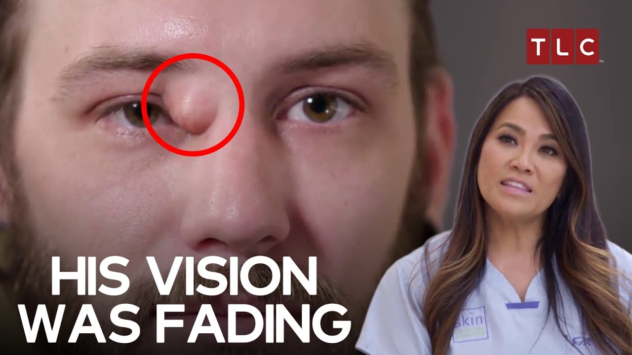 A Cyst Near Shane&rsquo;s Eye Turns Into A Dangerous Risk | Dr Pimple Popper S3 E12 | TLC India