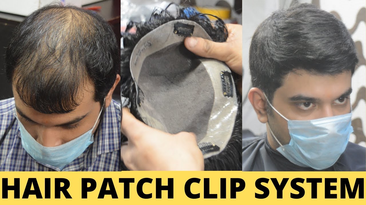 Hair Patch Clip System | Hair Patch Clipping System for Men in Delhi