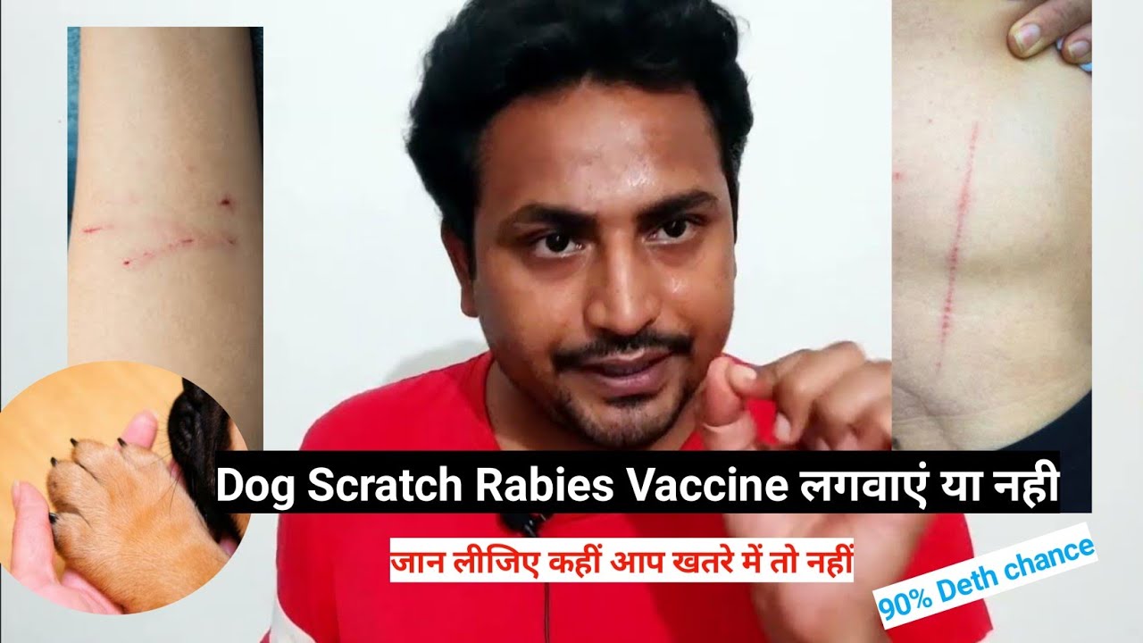 Dog Scratch Rabies Vaccine लगवाएं या नही |Bleeding नहीं हुआ| #dogcare #dogbite #jppharmacy