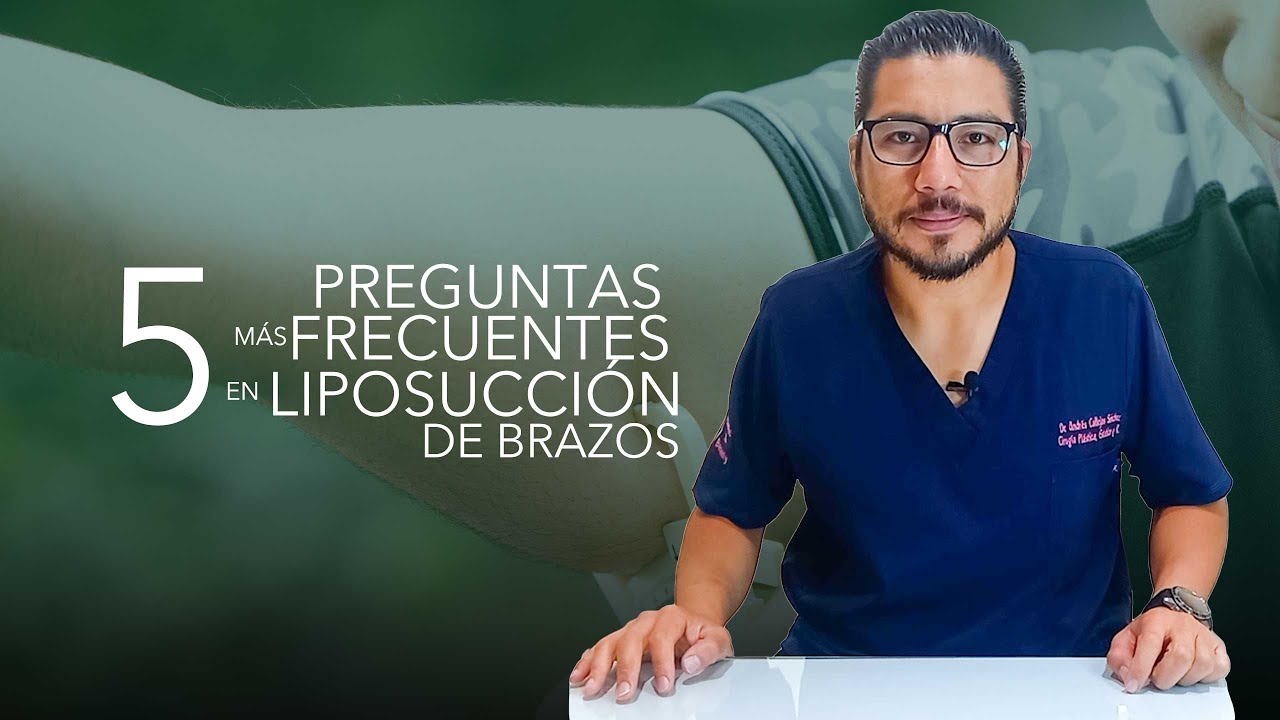 5 Preguntas Frecuentes para Liposucción de Brazos