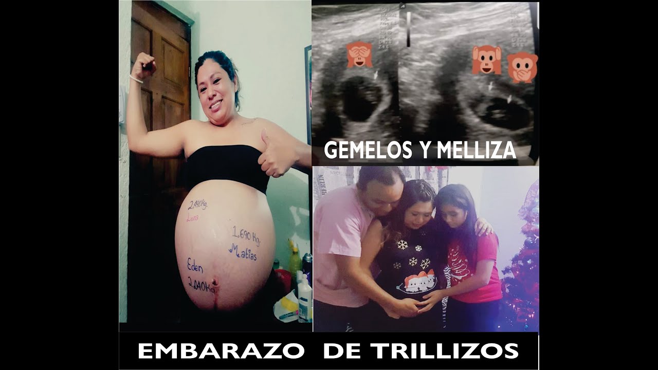 COMO ME FUE MI EMBARAZO DE TRILLIZOS Y COMO ME ENTERE