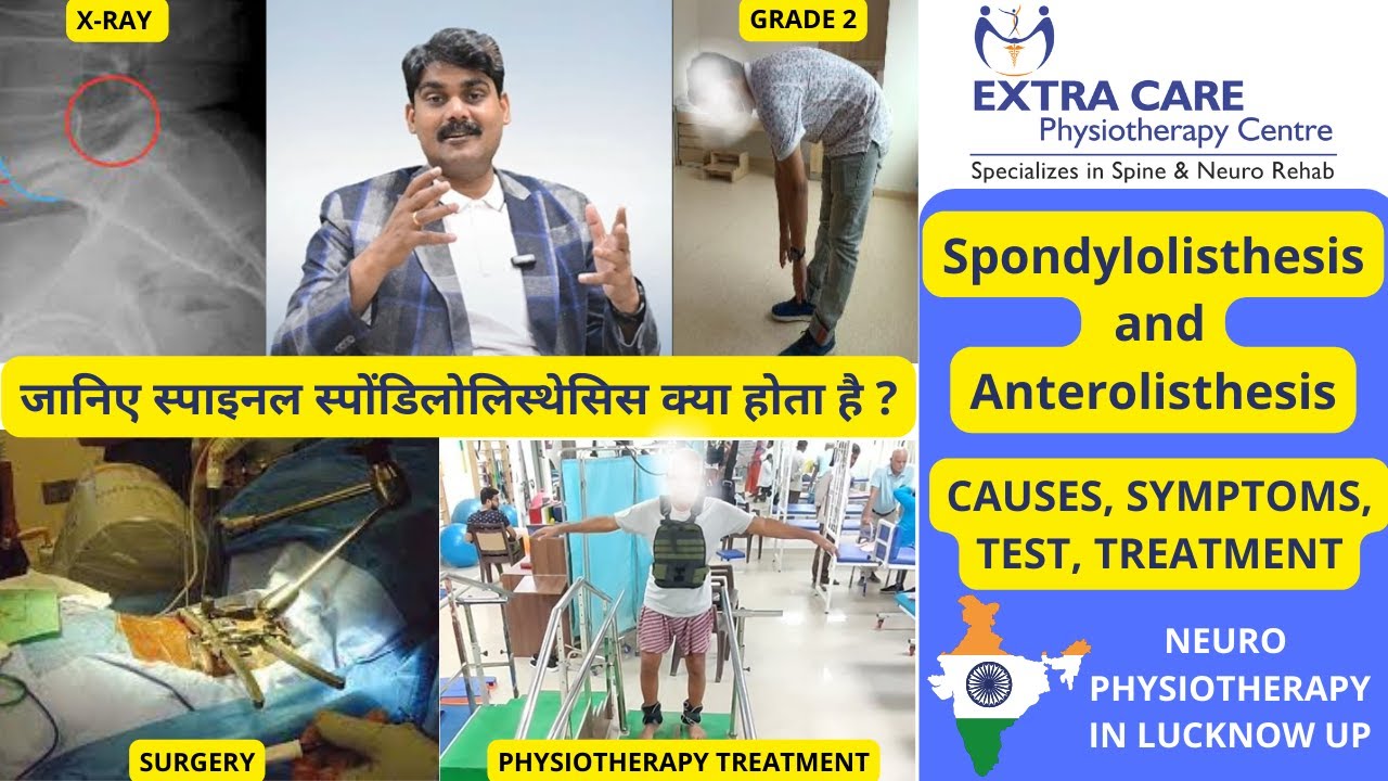Spinal Spondylolisthesis & Anterolisthesis | Full Grading system , Test, Symptoms and Physiotherapy