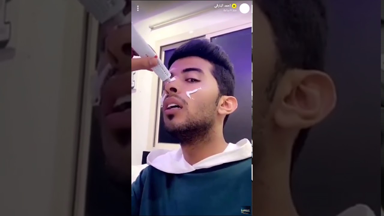 سنابات احمد البارقي معزوم عند ابو ثامر والحروق اللي بوجه 😱