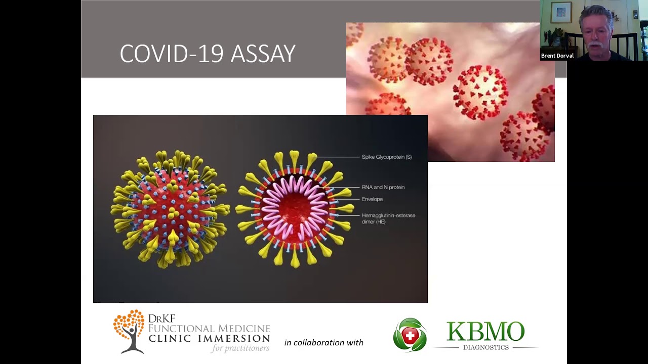 New IgG IgM Antibody Test for COVID 19 from KBMO Diagnostics