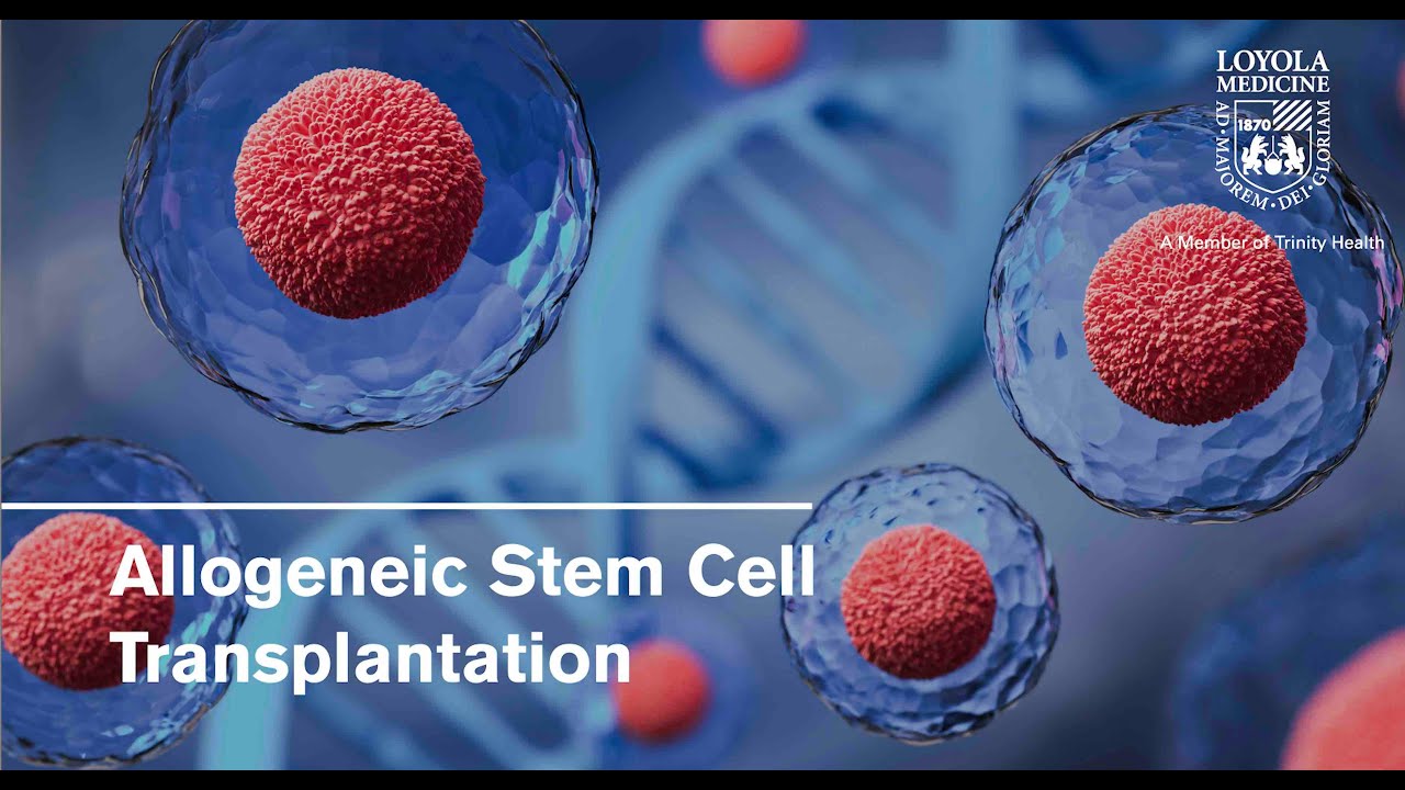 Allogeneic Stem Cell Transplantation for Blood or Bone Marrow Cancers