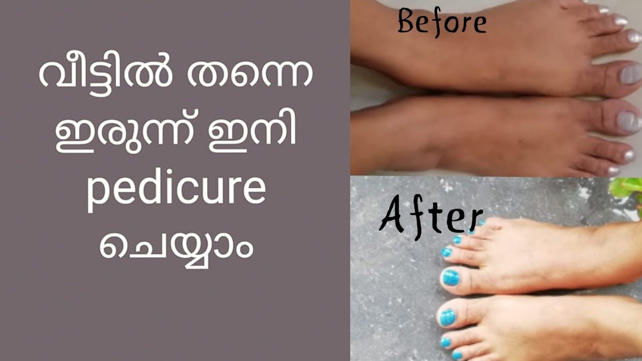 Pedicure at home / Malayalam / Feet Brightening