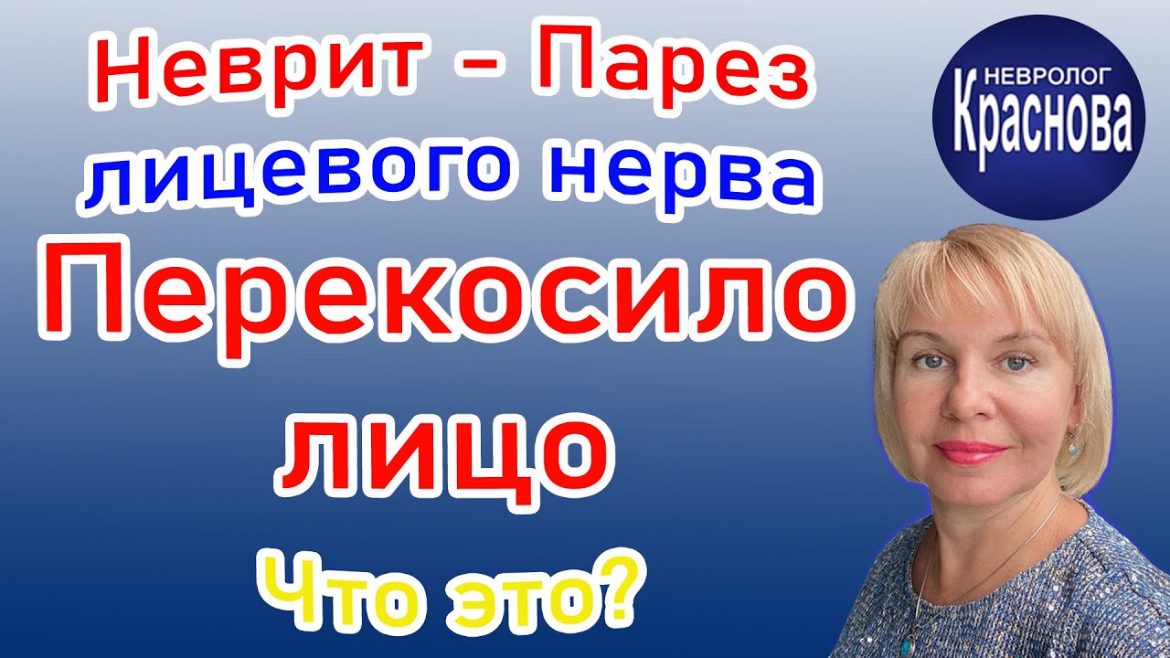 Неврит - Парез лицевого нерва. (Перекосило лицо) Что это? Невролог Краснова