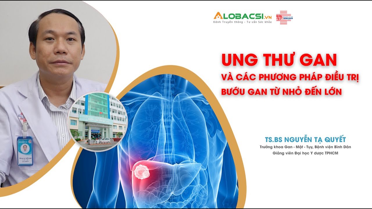 Ung thư gan và các phương pháp điều trị bướu gan từ nhỏ đến lớn | Bệnh viện Bình Dân