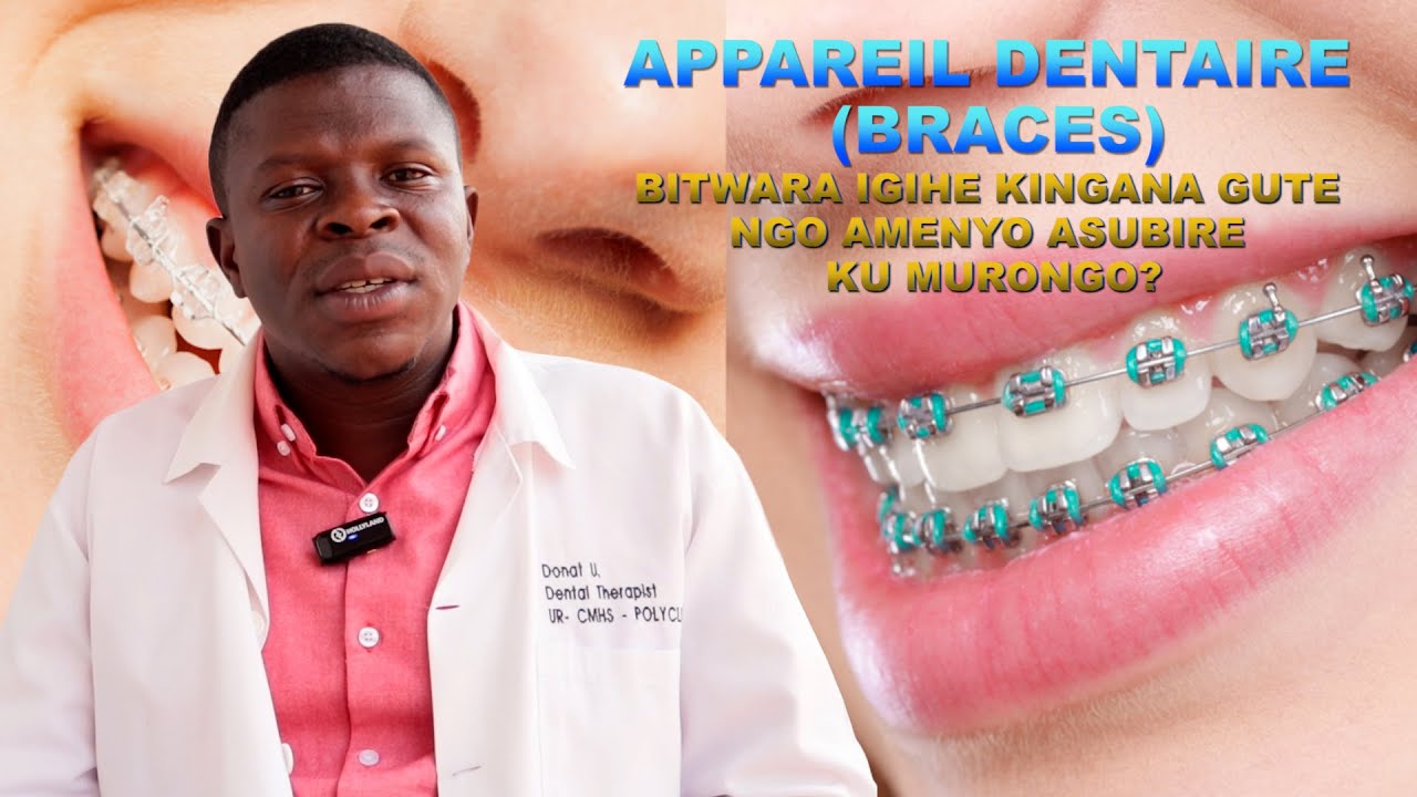 NI NDE UKENEYE APPAREIL (Braces) ZISUBIZA AMENYO KU MURONGO? BITWARA IGIHE KINGANA GUTE NGO UKIRE?