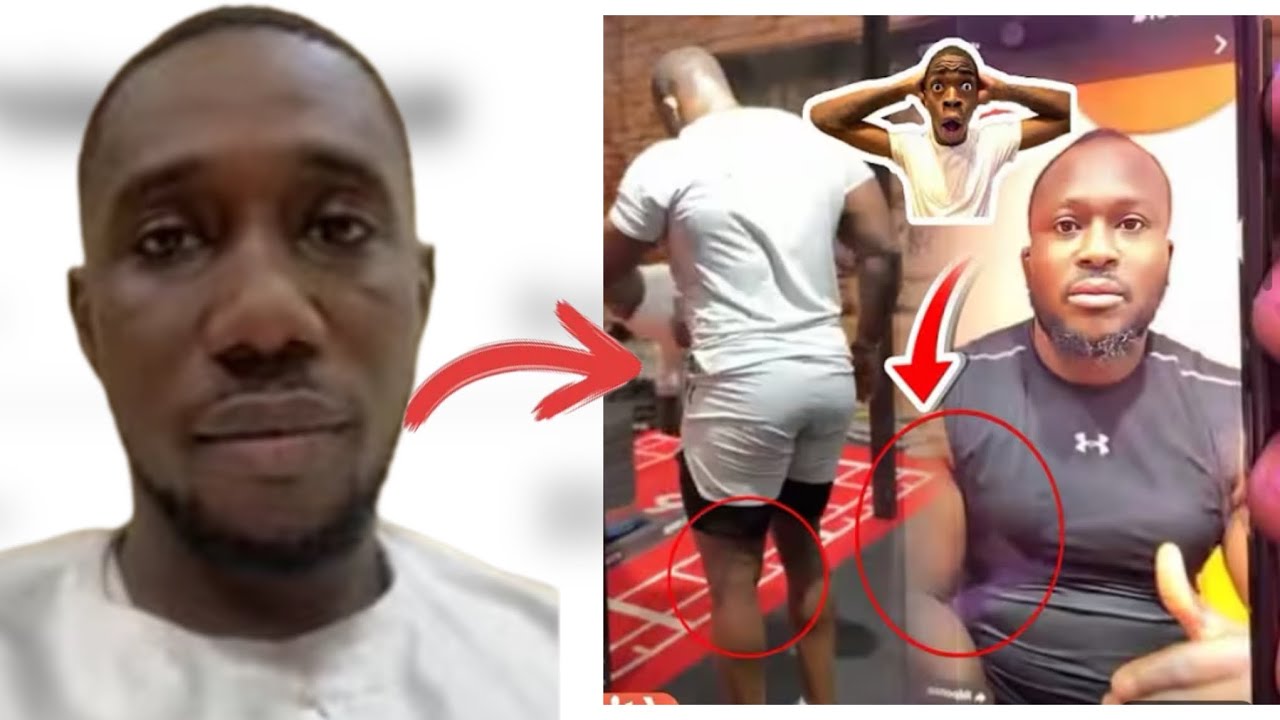 Images fuité de Modou Lo 🇫🇷….Docteur Jules catégorique et valide la forme ✅
