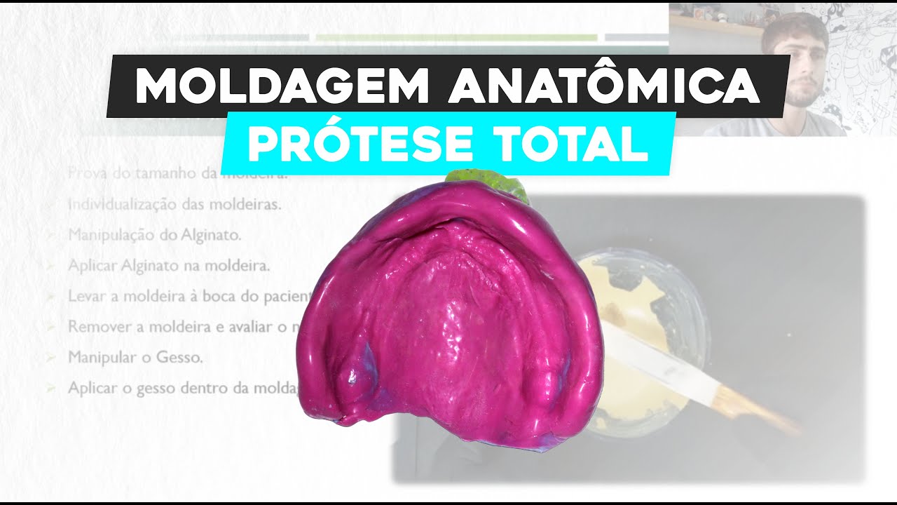 Moldagem Anat&ocirc;mica em Pr&oacute;tese Total: T&eacute;cnicas e Dicas para um Resultado Perfeito!