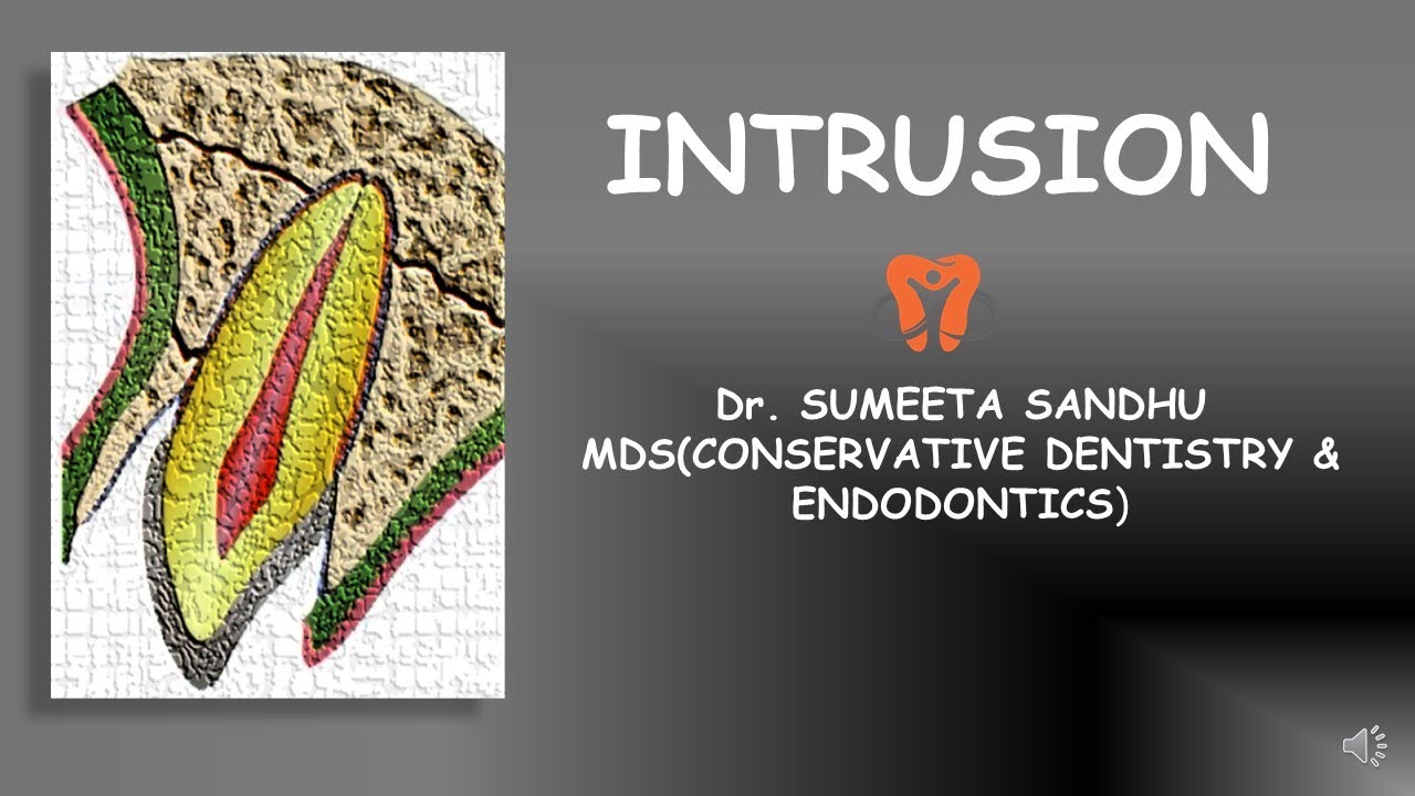 Tooth Intrusion Management