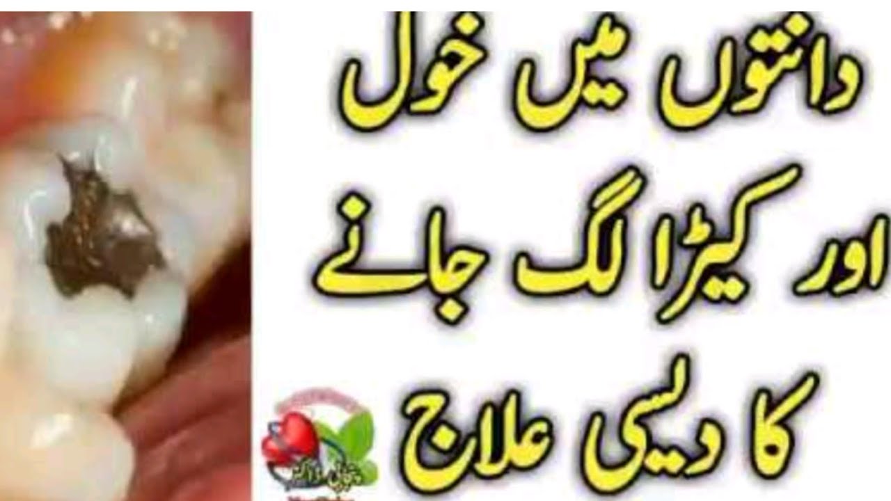 phatkari se danton ka ilaj #trendingnow #homeremedies #popularnow #viralvideo #vlog