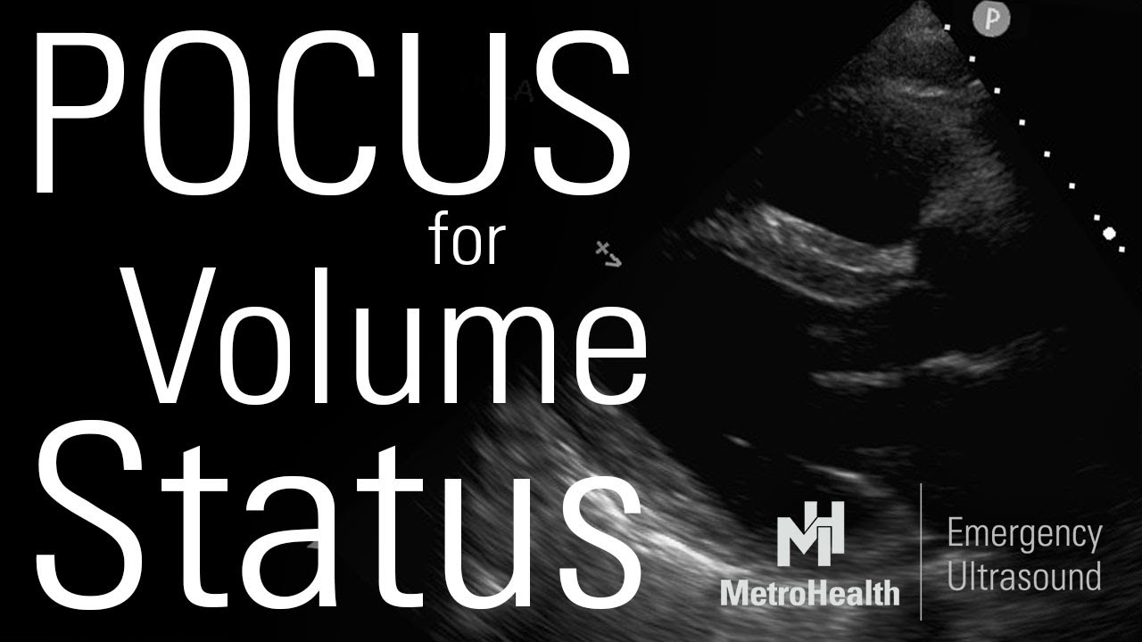 POCUS для определения объема в отделении интенсивной хирургической терапии