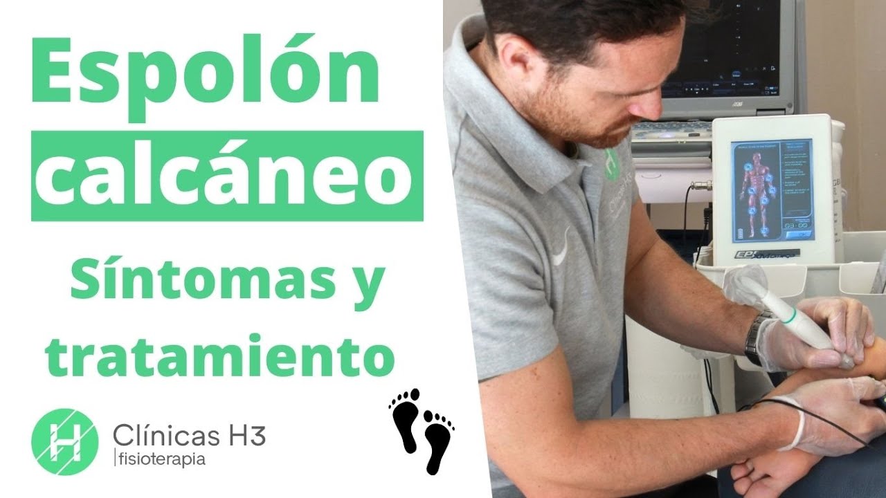 ESPOLÓN CALCÁNEO. Causas, síntomas y tratamientos⚠️ Dolor en el TALÓN👣