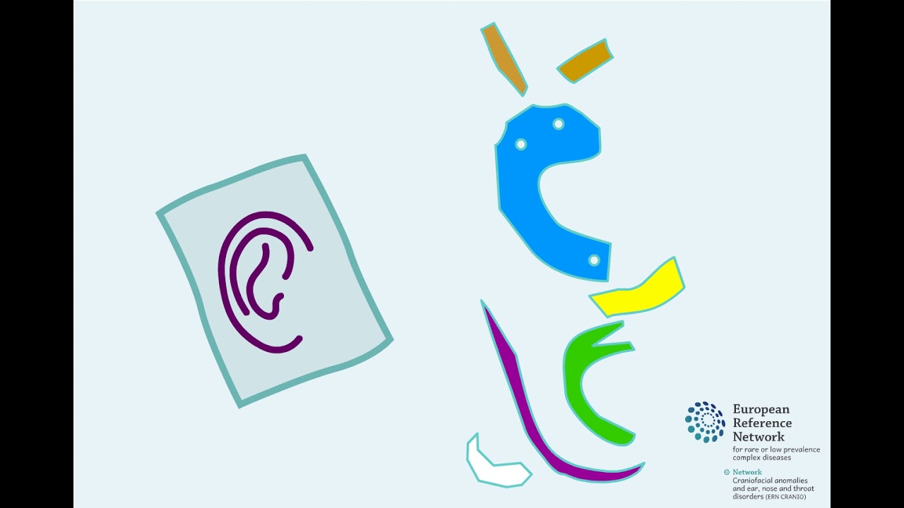 Ear Reconstruction - Microtia