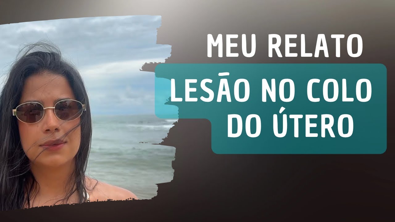 Lesão NIC III no colo do útero. Meu relato. 