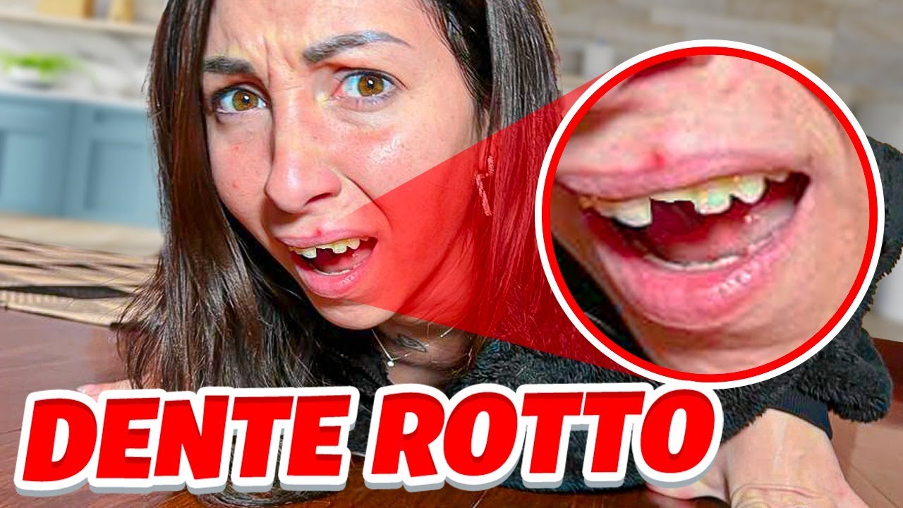 MAMMAGIULIA CADE E SI ROMPE IL DENTE E SI FA MALE E ESCE TANTO SANGUE E FINISCE IL OSPEDALE! *Aiuto*