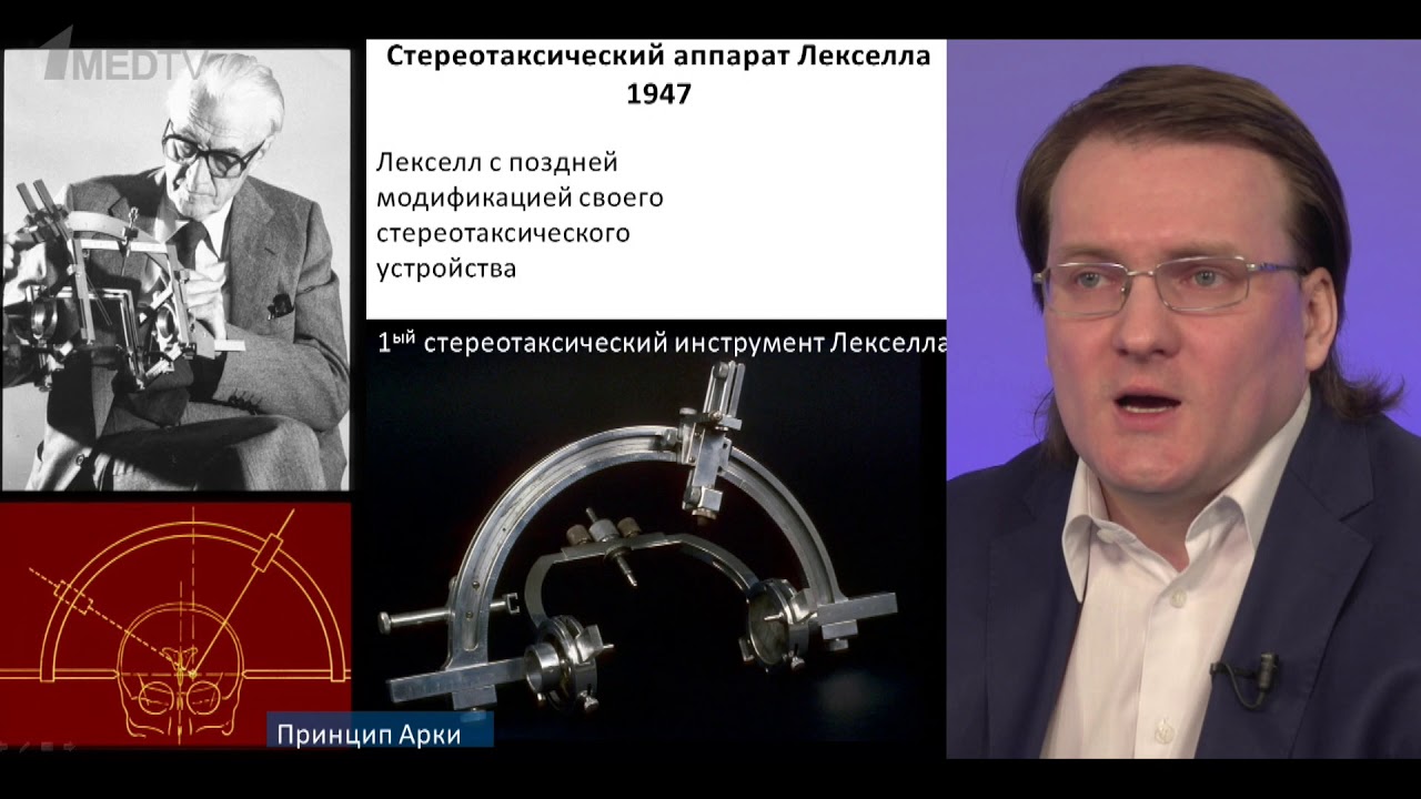 История гамма-ножа. Радиобиологические аспекты стереотаксического облучения